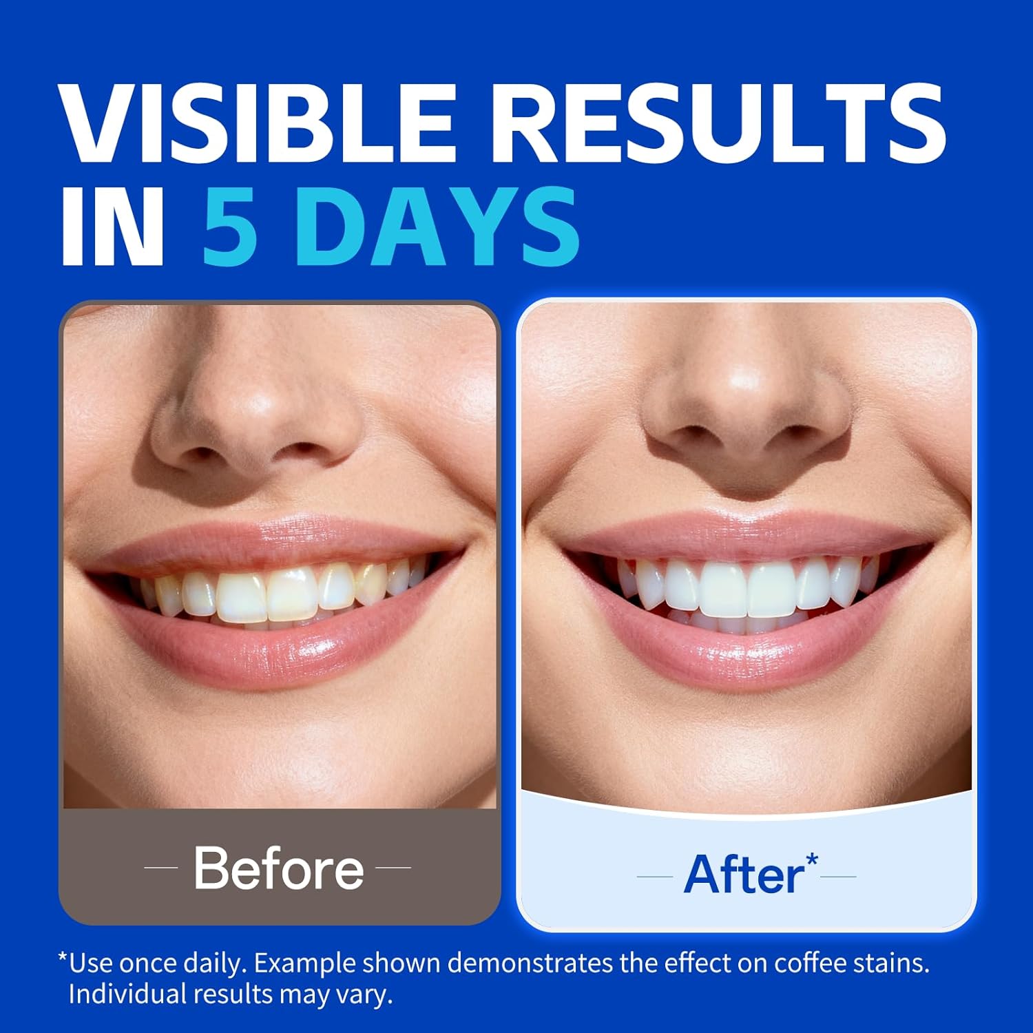 7 Paar Zahnaufhellungsstreifen – Teeth Whitening Strips Crest Bewertung und Preis