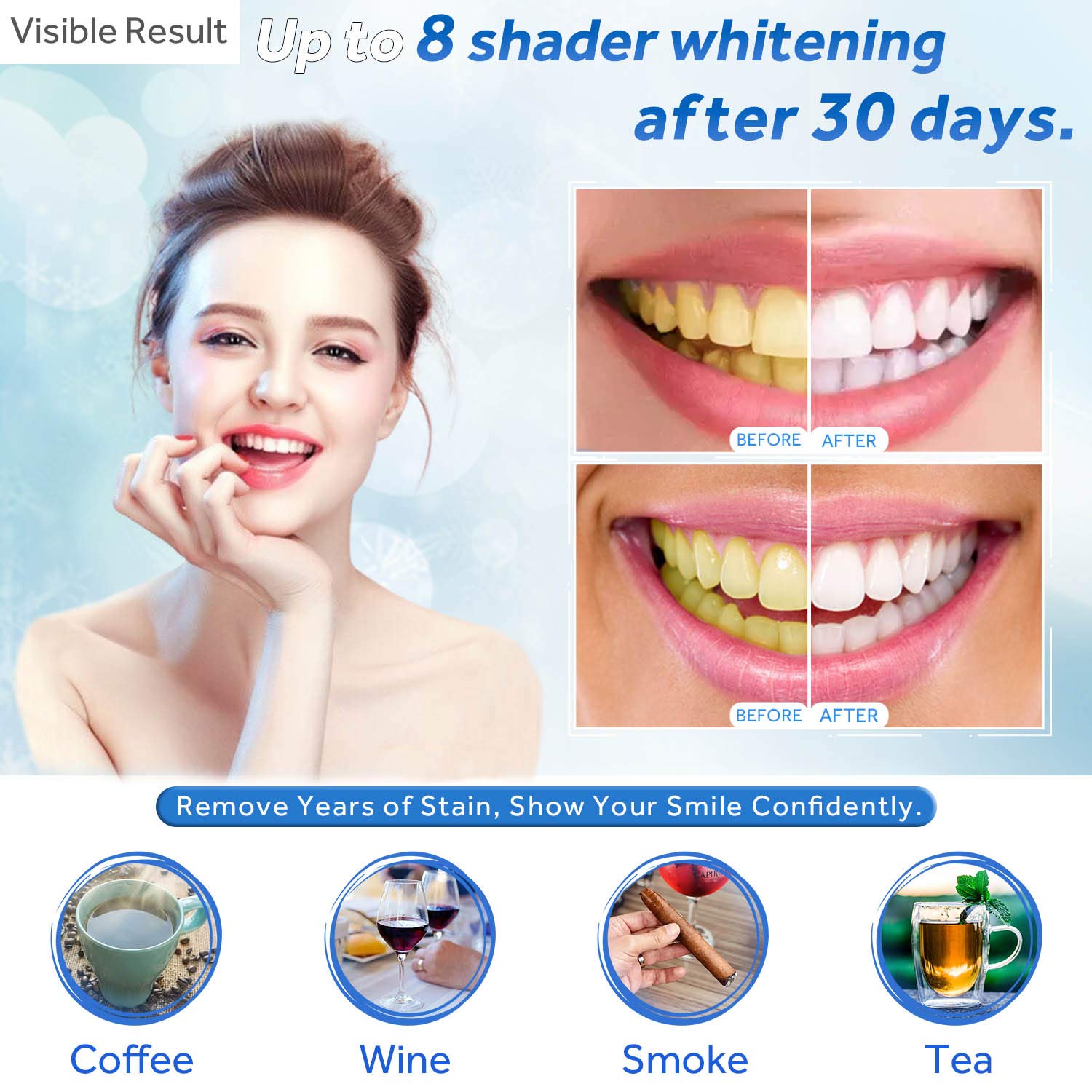 Zahnaufhellungsgel, Nachfüllsp – Teeth Whitening Accelerator Bewertung und Preis