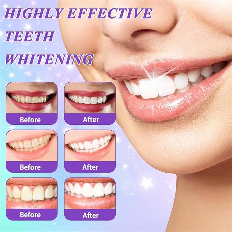 9D Lila Zahnaufhellungs-Zahnpa – Teeth Whitening Cream Bewertung und Preis