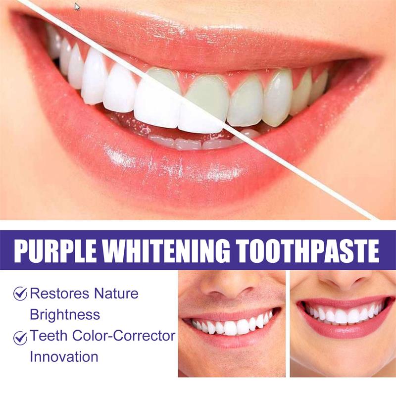 9D Lila Zahnaufhellungs-Zahnpa – Teeth Whitening Cream Bewertung und Preis