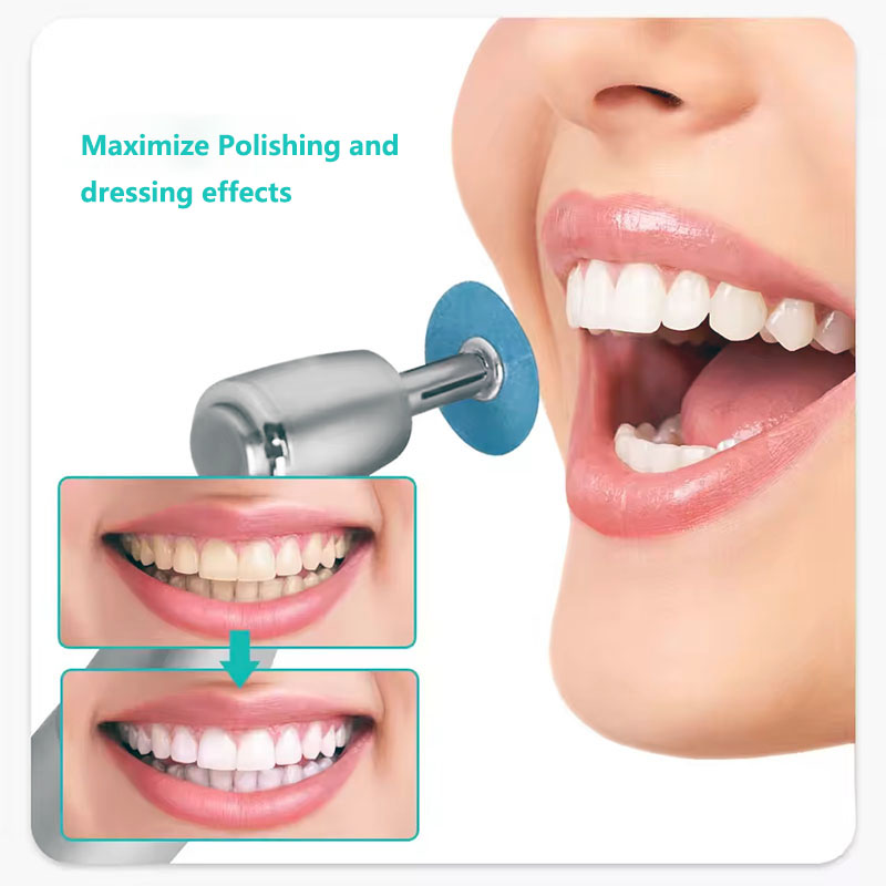 40 stücke Dental Polieren Sche – Teeth Whitening Kit Professional Bewertung und Preis