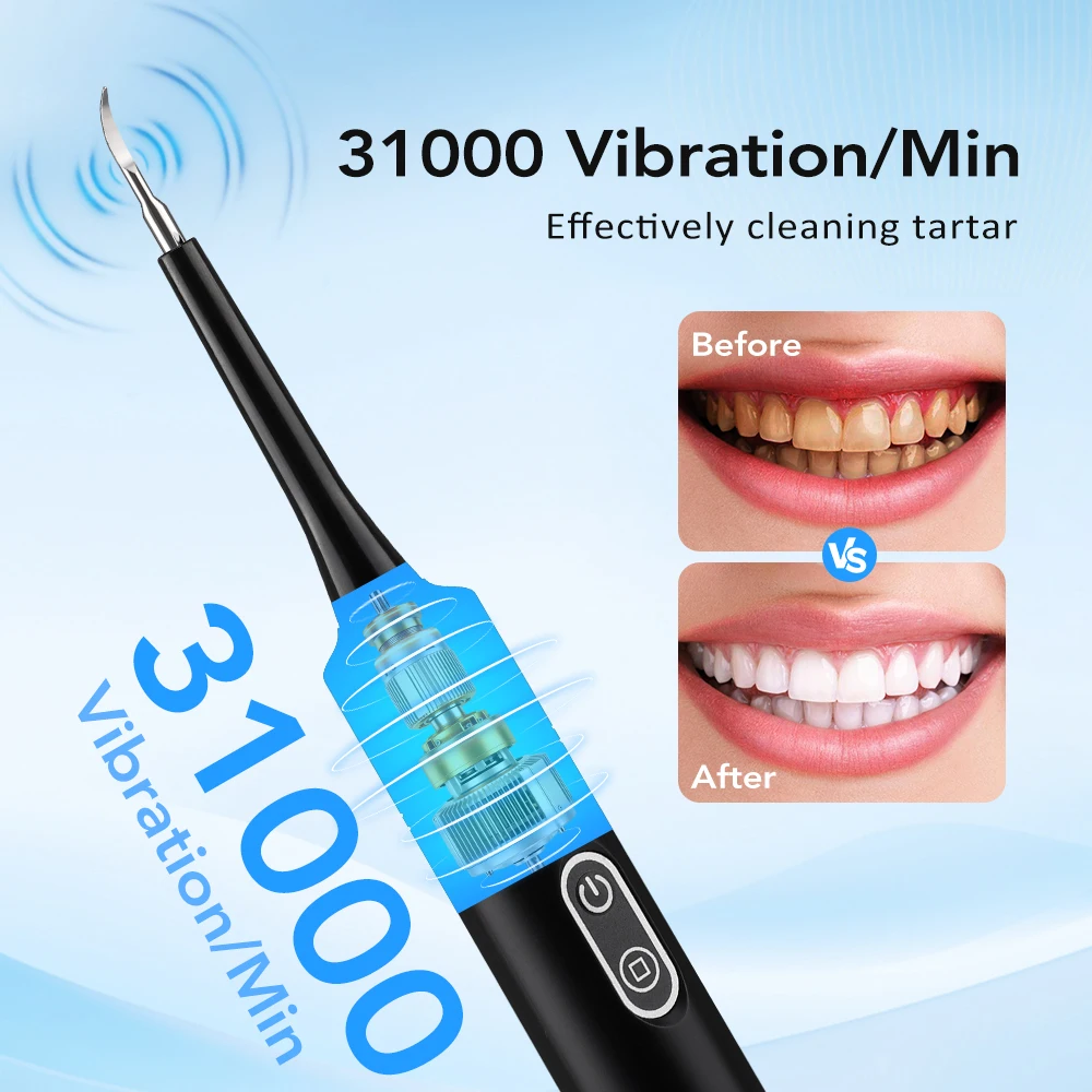 Elektrischer Schallvibrations- – Teeth Whitening Kit Professional Bewertung und Preis
